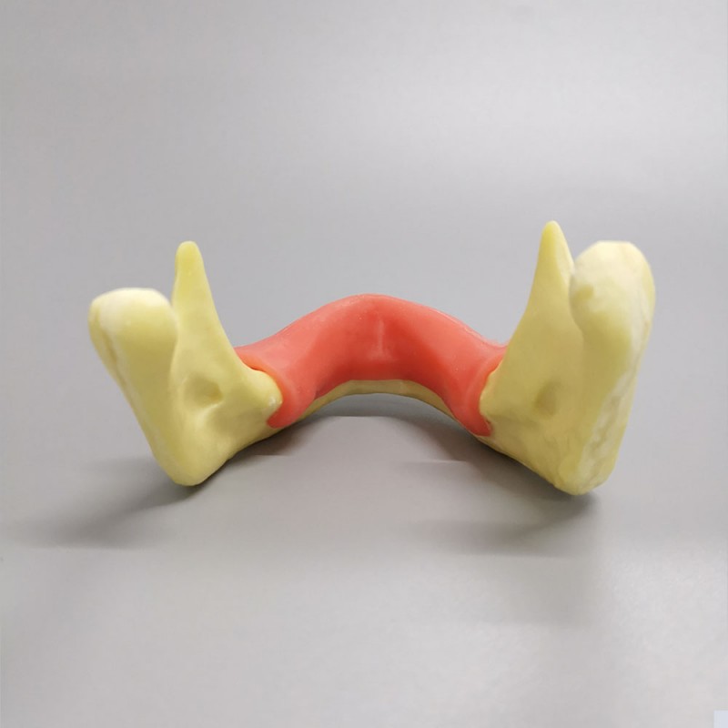 M2023 Implant Practice model jaw with soft gum