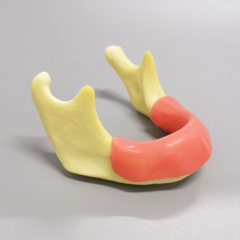 M2023 Implant Practice model jaw with soft gum