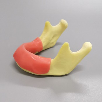 M2023 Implant Practice model jaw with soft gum