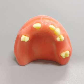 M2024 Implant Practice model upper jaw model partially edentulous model