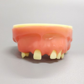 M2024 Implant Practice model upper jaw model partially edentulous model